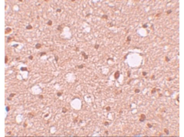 Immunohistochemistry of APBA2