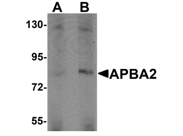 Western blot analysis of APBA2