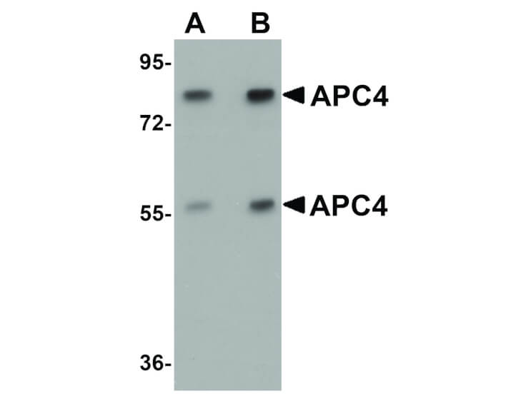 Western Blot of APC4 Antibody