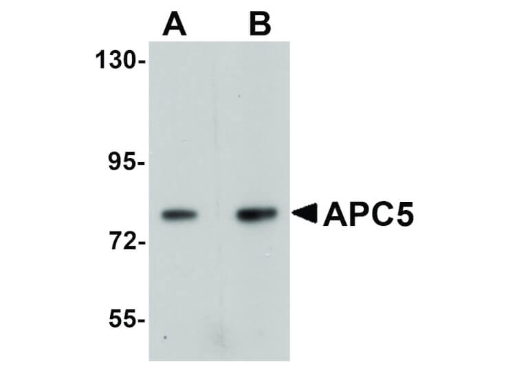 Western Blot of APC5 Antibody