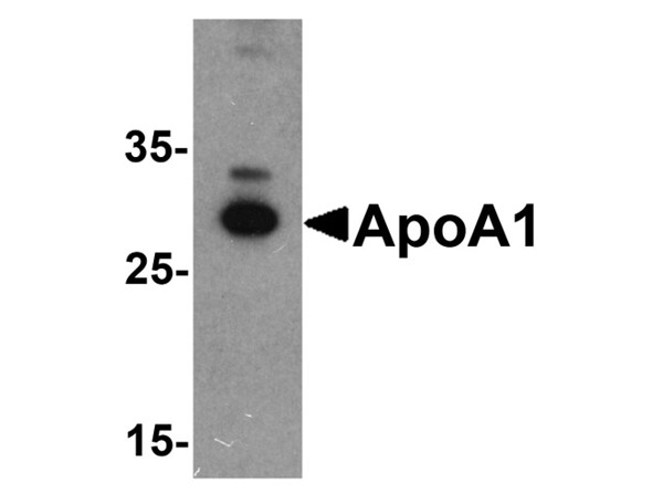 Western blot analysis of ApoA1