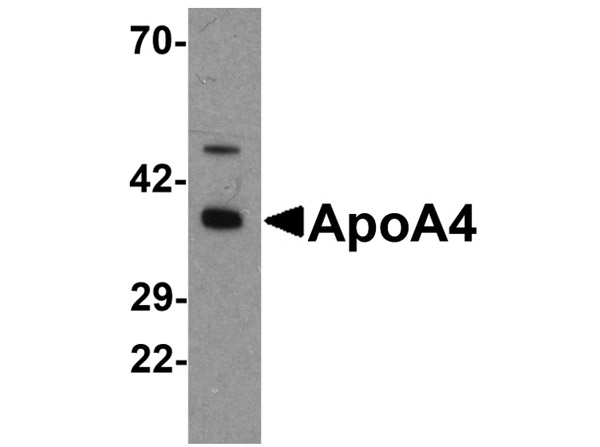 Western blot analysis of ApoA4