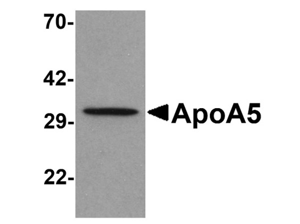 Western blot analysis of Apoliproprotein A-V