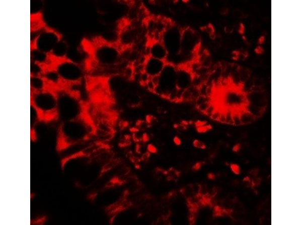 Immunofluorescence of APOBEC3B