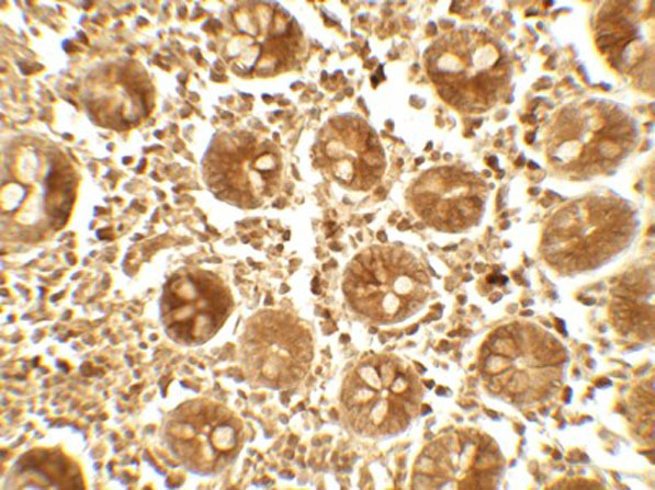 Immunohistochemistry of APOBEC3B