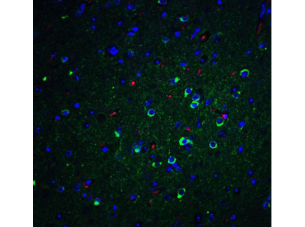 Immunofluorescence of Apolipoprotein E