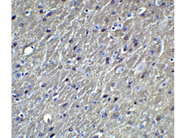 Immunohistochemistry of Apolipoprotein E