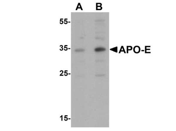 Western blot analysis of Apolipoprotein E