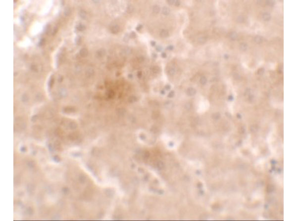 Immunohistochemistry of Apolipoprotein E