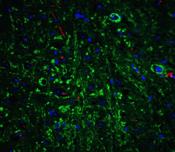Immunofluorescence of APP