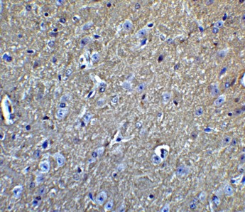 Immunohistochemistry of APP