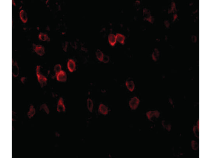 Immunofluorescence of APP Antibody