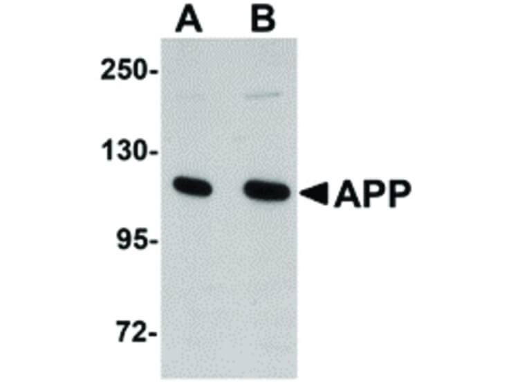 Western Blot of APP Antibody