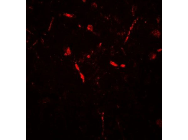 Immunofluorescence of APPBP2