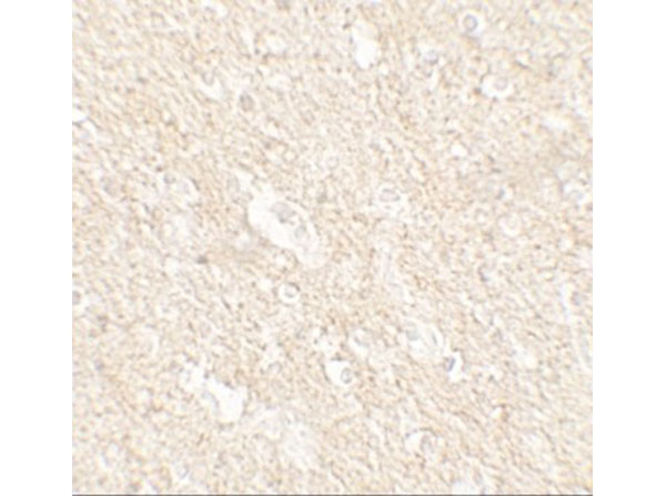 Immunohistochemistry of APPBP2