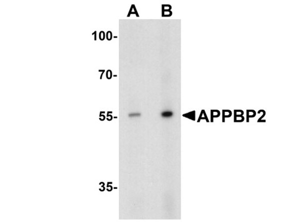 Western blot of APPBP2