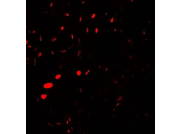 Immunofluorescence of AQP2