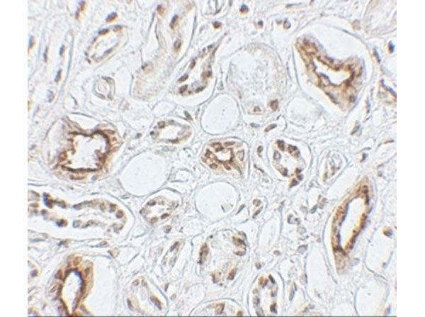 Immunohistochemistry of AQP2