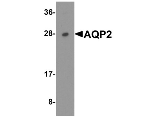 Western blot of AQP2