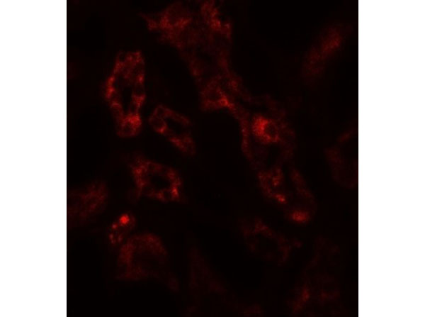 Immunofluorescence of ARF6