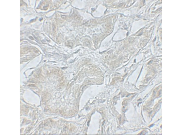Immunohistochemistry of ARF6