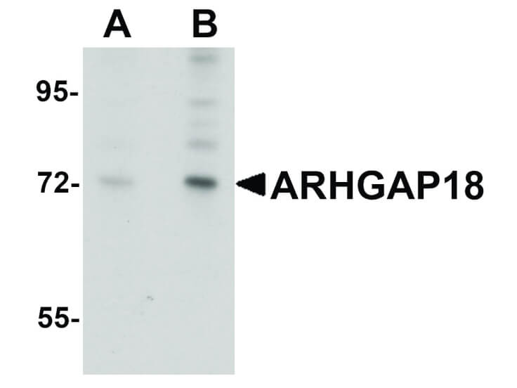 Western Blot of ARHGAP18 Antibody