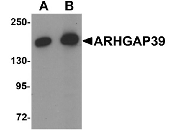 Western blot analysis of ARHGAP39