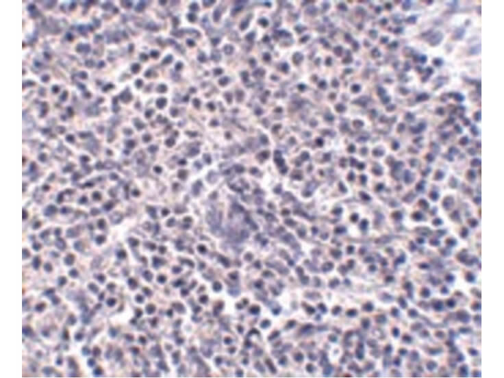 Immunohistochemistry of ARL15 Antibody