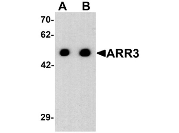 Western blot analysis of ARR3