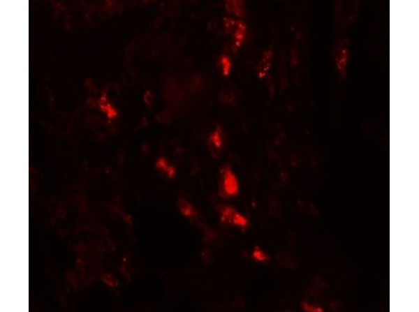 Immunofluorescence of ARSB