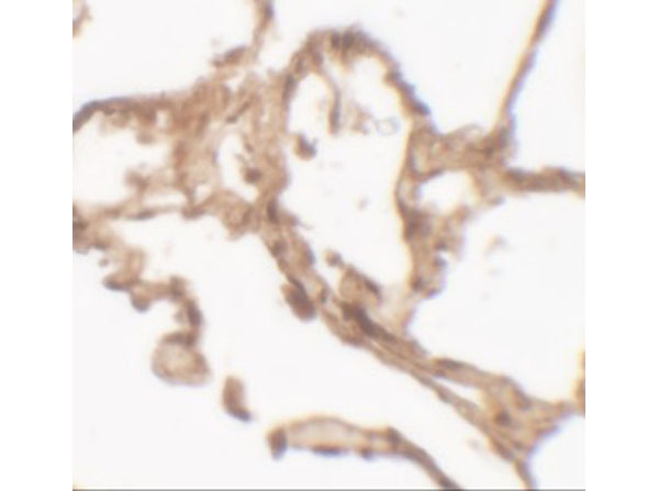 Immunohistochemistry of ARSB
