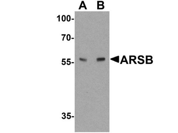 Western blot of ARSB