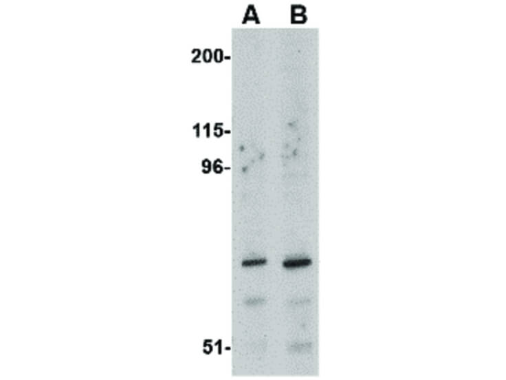 Western Blot of ASAH2 Antibody