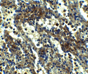 Immunohistochemistry Validation of ASC