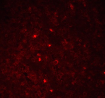 Immunofluorescence Validation of ASC