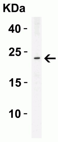 Western Blot Validation of ASC