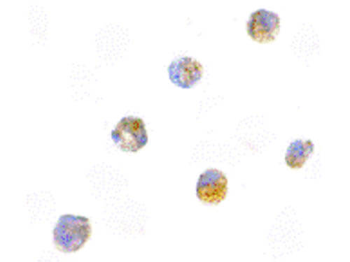 Immunocytochemistry of ASC Antibody