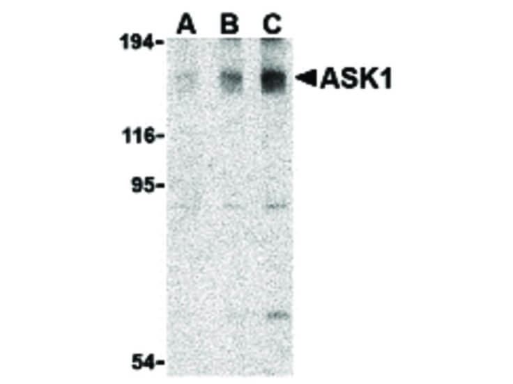 Western Blot of ASK1 Antibody