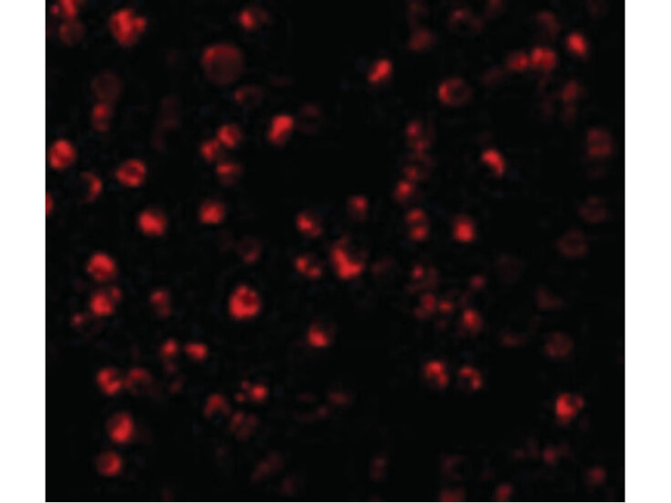 Immunofluorescence of ATF6 Antibody