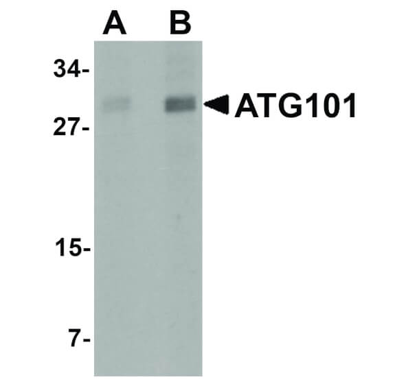 Western Blot of ATG101 Antibody