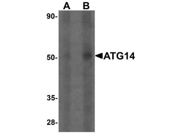 Western blot analysis of ATG14