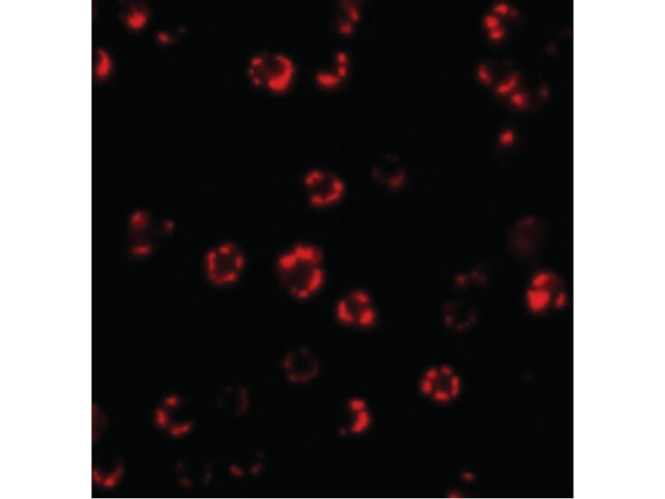 Immunofluorescence of ATG16 Antibody