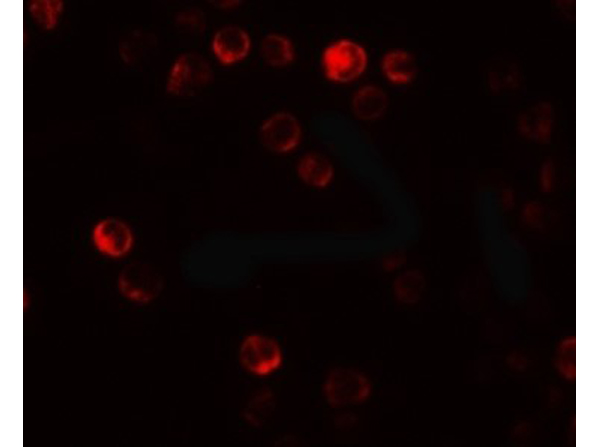 Immunofluorescence of ATG2B