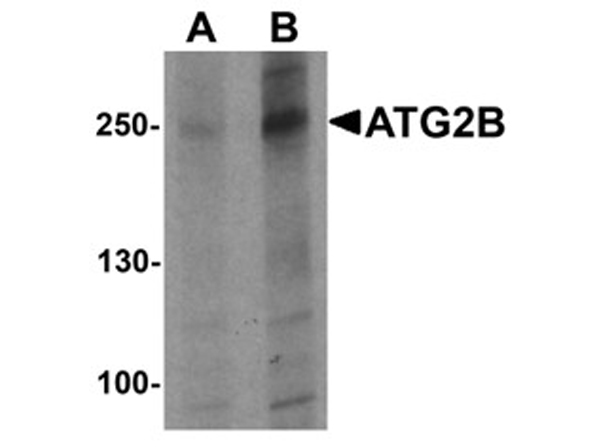 Western blot analysis of ATG2B