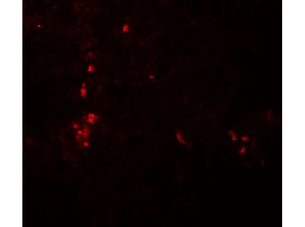 Immunofluorescence of Anti-ATG4B
