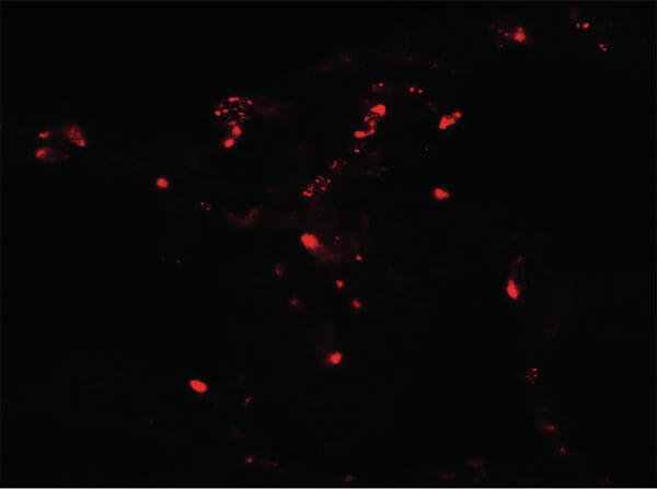 Immunofluorescence of ATG4C Antibody