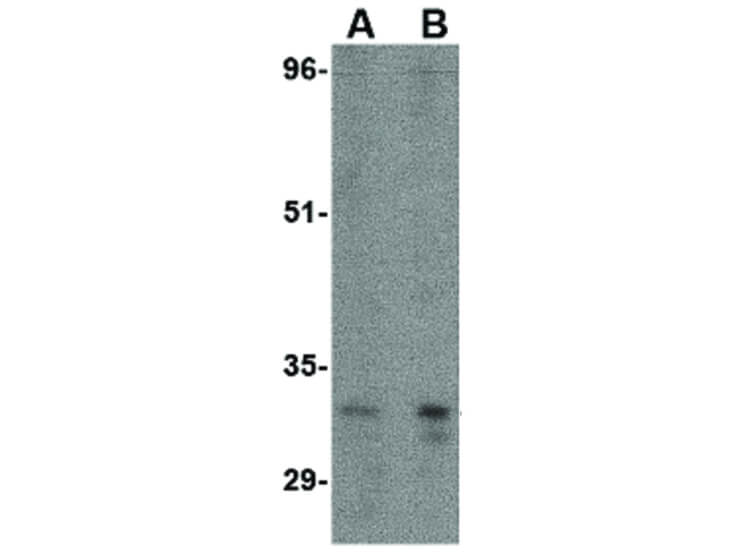 Western Blot of ATG5 Antibody