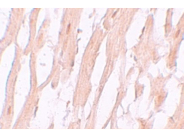 Immunohistochemistry of ATG9A