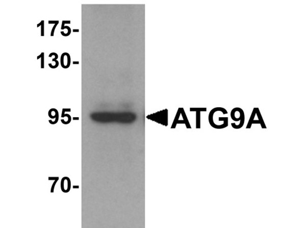 Western blot of ATG9A