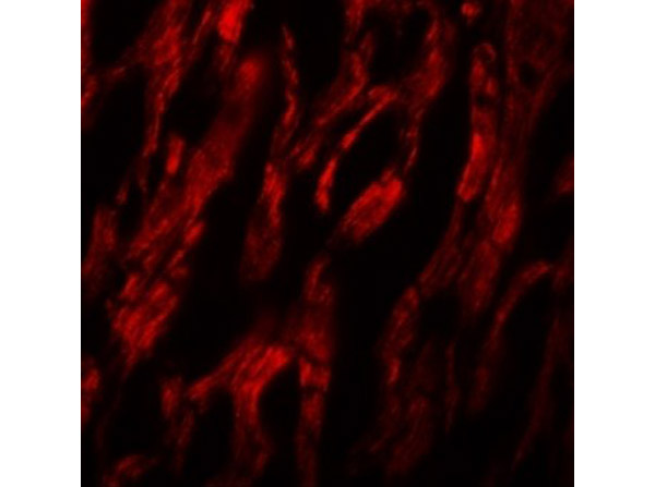 Immunofluorescence of ATG9A